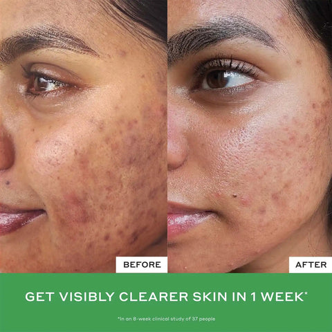 Daily D-Clog Pore-Clearing Cleanser